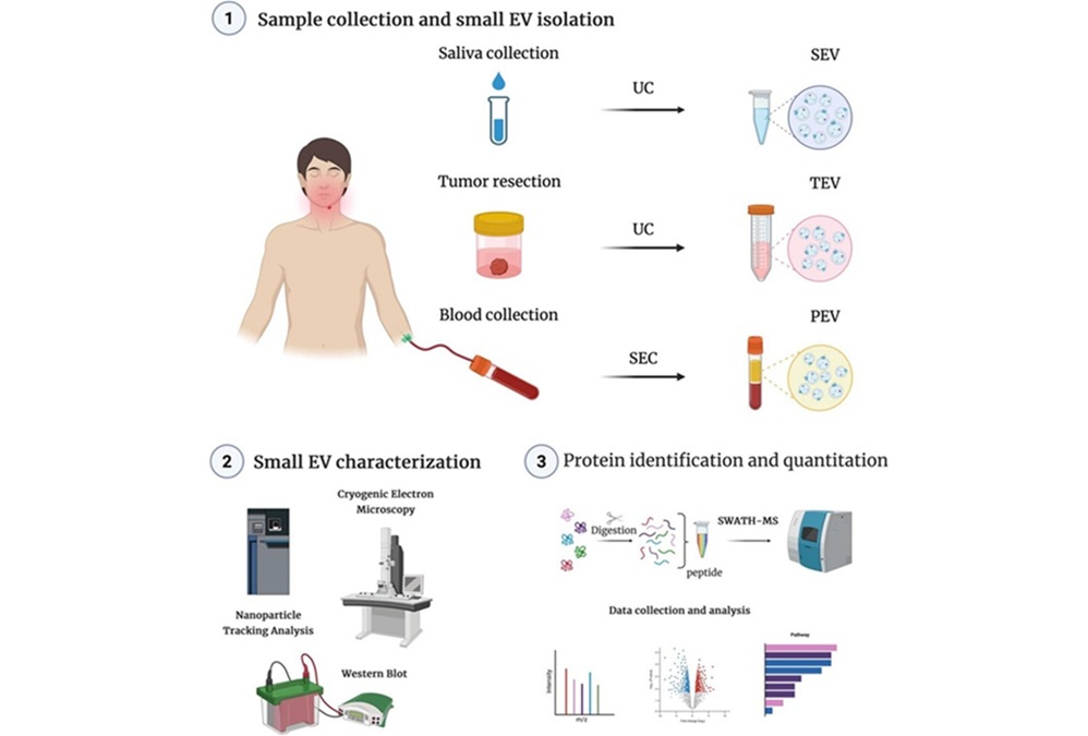 Image: Flowchart representing sample collections and small EV isolations from tissue, saliva, and plasma of HNC patients (A Jangholi et al., VIEW (2025). DOI: https://doi.org/10.1002/VIW.20250081)