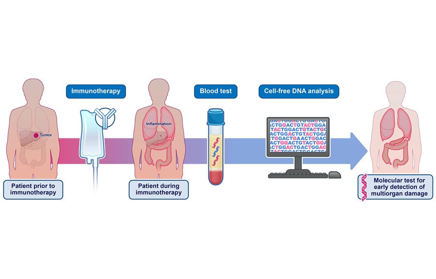 Image: The noninvasive cfDNA blood test can identify adverse events from immune checkpoint therapy in cancer patients (Photo courtesy of Elizabeth Cook)