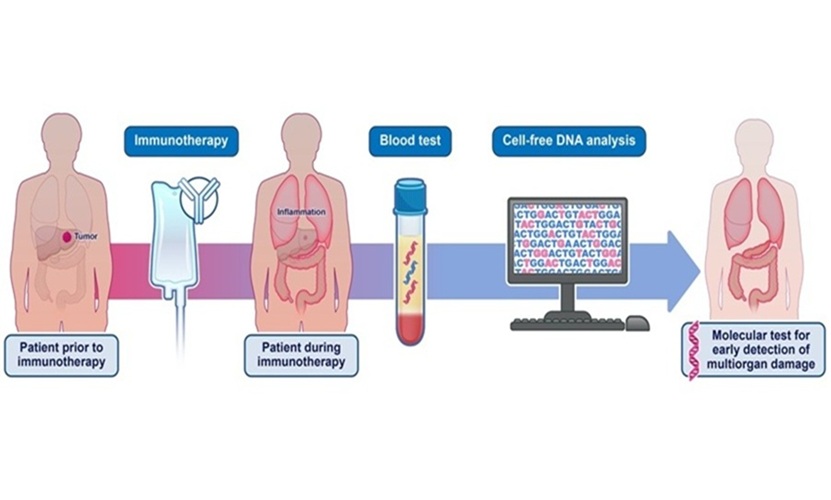 Image: The noninvasive cfDNA blood test can identify adverse events from immune checkpoint therapy in cancer patients (Photo courtesy of Elizabeth Cook)