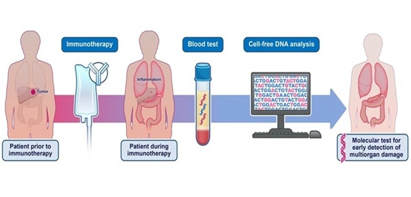 Image: The noninvasive cfDNA blood test can identify adverse events from immune checkpoint therapy in cancer patients (Photo courtesy of Elizabeth Cook)