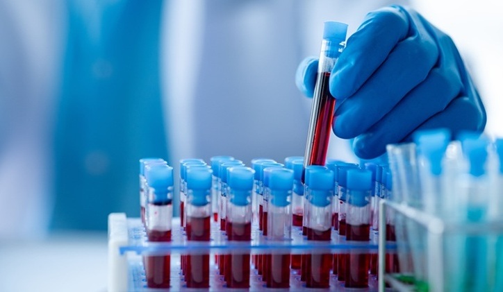 Image: A blood biomarker test offers a clearer prognosis after cardiac arrest (Photo courtesy of Adobe Stock)