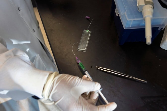 Image: The GlioExoChip chip provides a quick and minimally invasive way to monitor glioblastoma treatment response (Photo courtesy of University of Michigan)