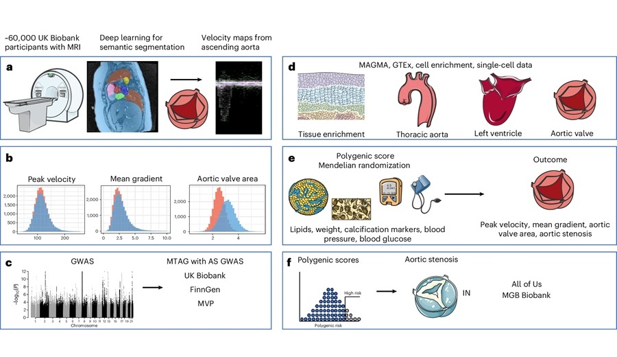 Image: AI and genetics can reveal early clues behind aortic stenosis risk (Kany, S., Rämö, J.T., Hou, C. et al., Nature Genetics (2025). DOI: 10.1038/s41588-025-02397-7)