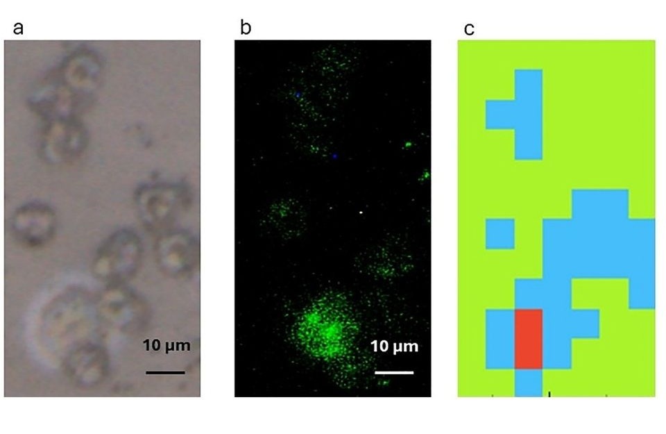 Image: Advanced infrared microspectroscopy enables detection of individual circulating tumor cells in blood samples (Dowling L, et al., Applied Spectroscopy (2025). DOI: 10.1177/00037028251390565)