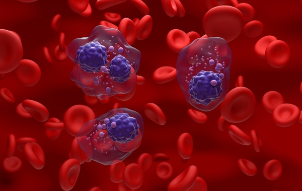 Image: The new blood test aims to detect early relapse in high-risk myeloma patients (Photo courtesy of Shutterstock)