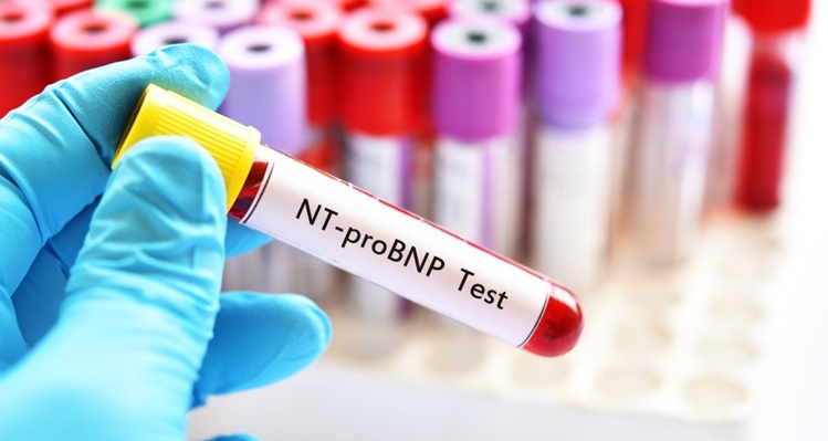 Image: The blood test may help predict risk in hypertrophic cardiomyopathy (Photo courtesy of Shutterstock)