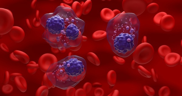 Image: The new blood test aims to detect early relapse in high-risk myeloma patients (Photo courtesy of Shutterstock)