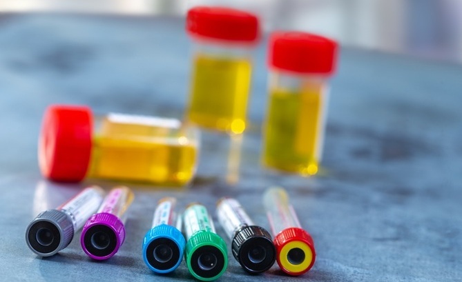 Image: The updated expert guidance helps EDs align urine drug testing with evolving drug trends and technologies (Photo courtesy of 123RF)