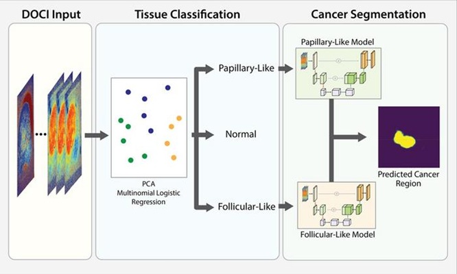 Image: AI models combined with DOCI can classify thyroid cancer subtypes (Photo courtesy of T. Vasse et al., doi 10.1117/1.BIOS.3.1.015001)