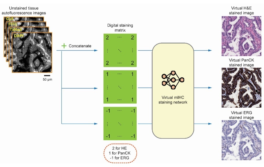 Image: Deep learning-enabled virtual multiplexed immunostaining of label-free tissue for vascular invasion assessment (Photo courtesy of UCLA)