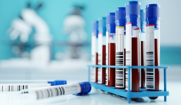 Image: Blood biomarkers linked to metabolism and inflammation may help predict chronic diseases in older adults (Photo courtesy of Adobe Stock)