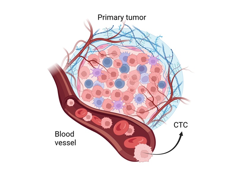 Image: Advanced single-cell analysis identifies new surface markers on circulating tumor cells in aggressive breast cancer (Wikimedia Commons, CC BY-SA 4.0)