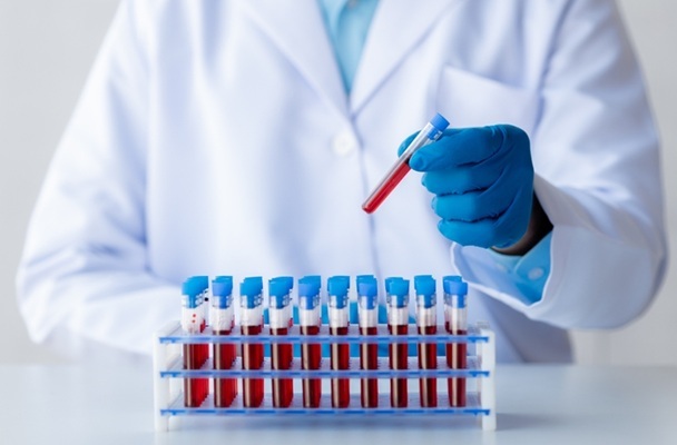 Image: Blood protein signature may help identify cancer earlier in patients with non-specific symptoms (Photo courtesy of Shutterstock)