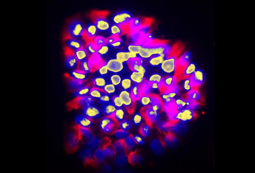 Image: Group of human colon cancer cells with invasive behavior (Photo courtesy of Ariel Ruiz i Altaba/UNIGE)