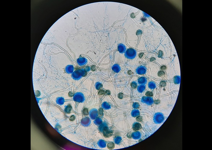 Image: The FungiFlex Mold Panel identifies over 95% of the most common invasive fungal pathogens in the U.S (Photo courtesy of Shutterstock)