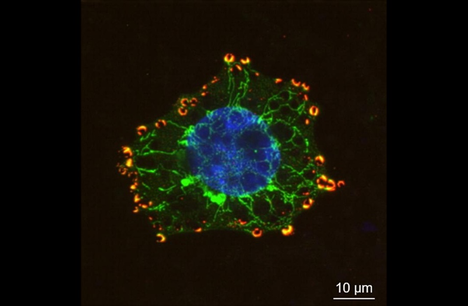 Image: Fluorescently labeled cell showing the cell body in green, the cytoskeleton in blue, the cell nucleus in yellow (Photo courtesy of Chalom Zemmour/Center for Nanoscience and Nanotechnology)