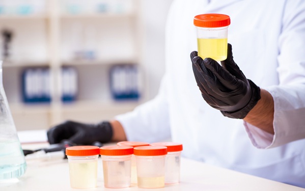 Image: Advanced urine DNA sequencing can distinguish true residual bladder cancer from age-related mutations in surrounding tissue (Photo courtesy of Shutterstock)