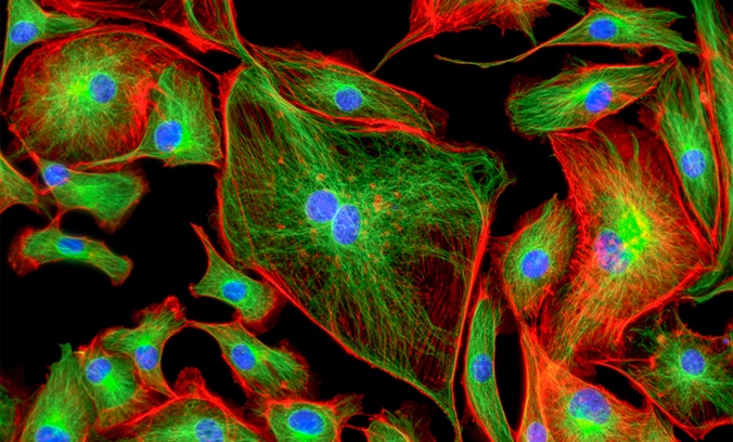 Image: Image: The clinically robust and prognostic CAF subtypes are predictive of immunotherapy response (Photo courtesy of Shutterstock)