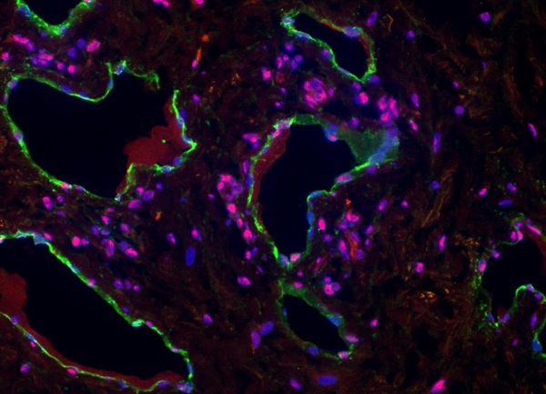 Image: In people born with lymphatic system disorders, too many vessels (outlined in green) are created for the lymphatic system (Photo courtesy of Carrie Shawber)