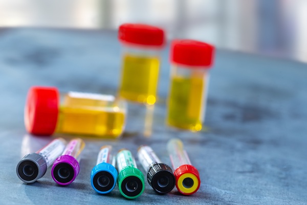 Image: The urine-based genetic test enables earlier detection of lynch syndrome-linked urinary tract cancers (Photo courtesy of 123RF)