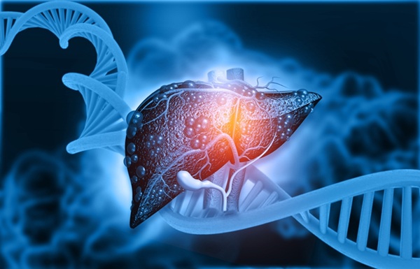 Image: AI blood-based cell-free DNA analyses detect early liver fibrosis and other diseases (Photo courtesy of Shutterstock)