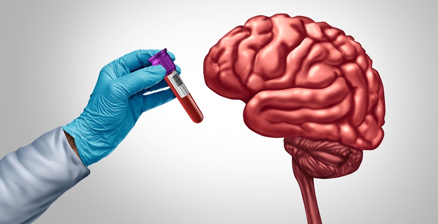 Image: The partnership with LLS expands access to Lucent’s non-invasive blood-based biomarker tests for early detection of cognitive diseases (photo courtesy of Adobe Stock)