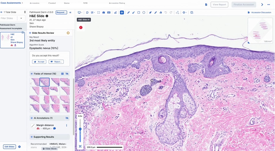 Image: PathAssist Derm streamlines specimen orientation, case prioritization, and measurement (Photo courtesy of PathAI)