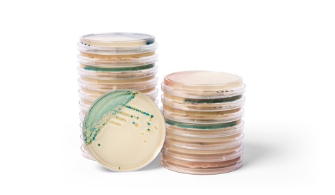 Image: Thermo Scientific Brilliance Candida 2 Agar and Spectra Candida Agar, color-based (chromogenic) culture media are designed to help laboratories quickly detect and differentiate clinically important Candida species (Photo courtesy of Thermo Fisher Scientific