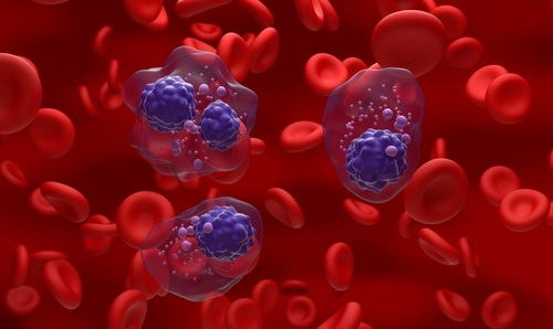 Image: The open-access tool that improves prediction of progression from smoldering multiple myeloma to active disease (photo courtesy of Shutterstock)terstock)