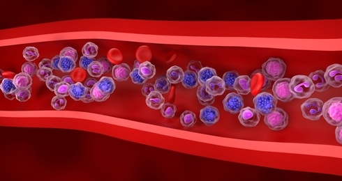 Image: The assay serves as an adjunctive tool in evaluating patients suspected of B-cell lymphoproliferative disorders (photo courtesy of Shutterstock)