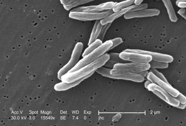 Image: Mycobacterium tuberculosis bacteria seen with a scanning electron microscope (Credit: CDC PHIL)