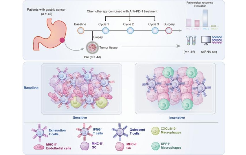 Image: Through neoadjuvant therapy combining chemotherapy with immune checkpoint inhibitors (ICI) for 46 LAGC patients and single-cell transcriptome sequencing, researchers found that tumor cells in the treatment-sensitive group specifically upregulated MHC-II (tumor-specific major histocompatibility complex class II, tsMHC-II) molecules (photo courtesy of Science China Press)