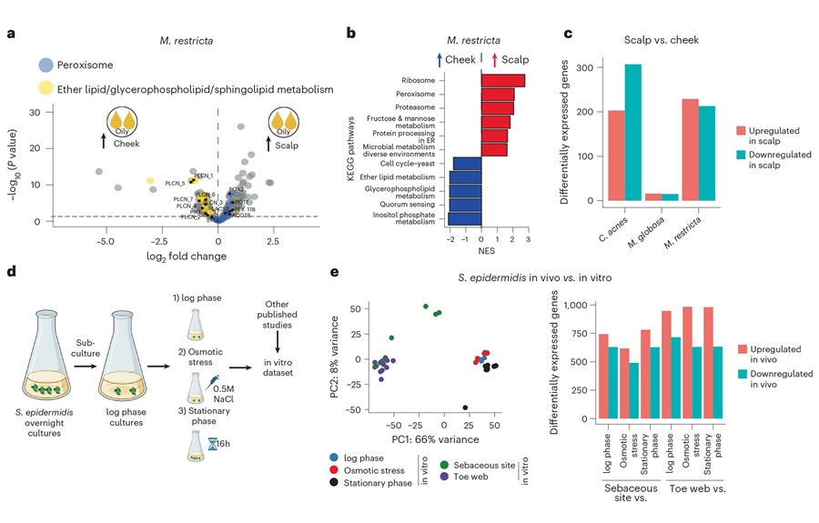 Image: Species-level differential enrichment of metabolic pathways in various in vivo and in vitro growth conditions (Minghao Chia et al, Nature Biotechnology (2025). DOI: 10.1038/s41587-025-02797-4)