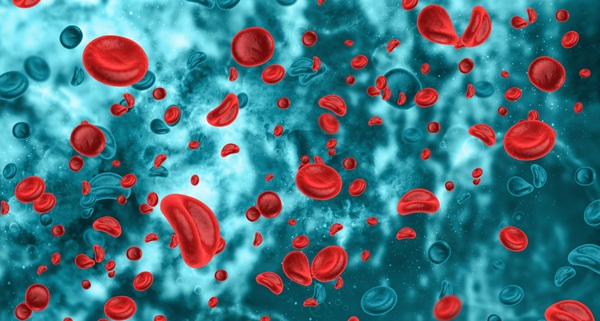 Image: The findings suggest anemia may signal underlying disease, with routine blood tests helping identify patients needing closer follow-up (photo courtesy of 123RF)