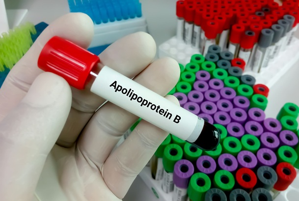 Image: ApoB is a blood test that counts the total number of harmful particles in circulation, providing a more complete assessment of risk (photo courtesy of Adobe Stock)