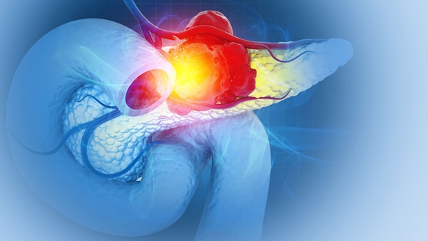 Image: The assay evaluates multiple cancer‑associated signals together to support risk assessment for early detection (photo credit: Adobe Stock)