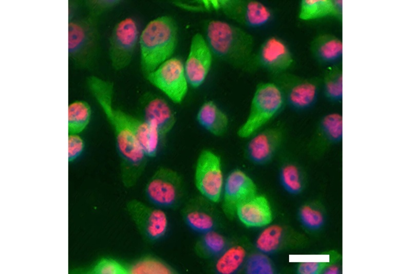 Image: Immunofluorescence staining showing that overexpression of WWOX (green) in A431 cells is associated with increased levels of p63 (red) (photo courtesy of Tirza Bidnay-Mizrahi)