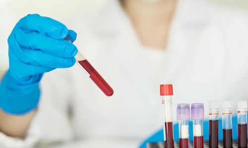 Image: The mRNA Gene Biomarker Test uses standard blood samples to generate a probability score distinguishing schizophrenia from bipolar I disorder (photo courtesy of Laguna Diagnostics)