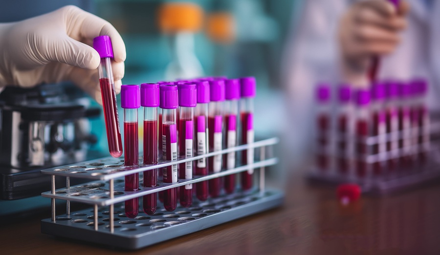 Image: The minimally invasive, cost-effective liquid biopsy offers an accessible alternative to tissue biopsy for tailoring breast cancer treatment strategies (photo credit: 123RF)