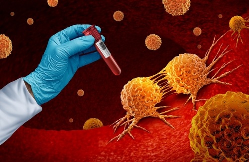 Image: The findings could enable noninvasive liquid biopsy profiling of the complex tumor microenvironment, helping guide precision oncology decisions across cancers and therapies (Photo credit: Shutterstock)