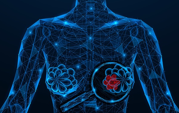 Image: ArteraAI Breast analyzes digitized histopathology images alongside patient clinical variables to produce an AI-derived risk score that provides prognostic insight into the likelihood of distant metastasis (Image credit: Adobe Stock)
