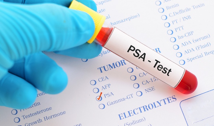 Image: An updated review finds that prostate cancer blood tests likely reduce the risk of death, revising earlier findings that evidence was insufficient (photo courtesy of iStock)