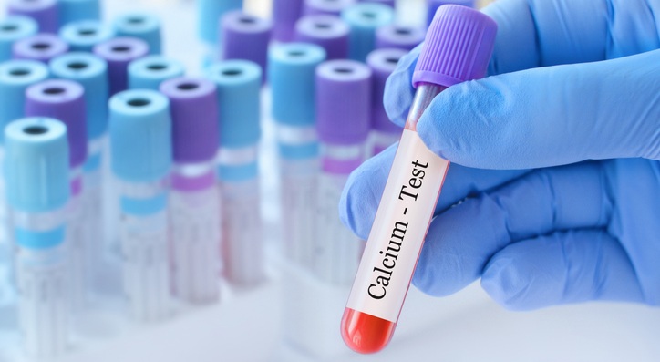 Image: For decades, laboratories have adjusted total calcium for albumin, but growing evidence shows these corrections often perform poorly and may cause harm (image credit: iStock)
