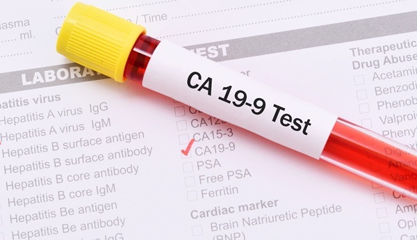Image: New findings suggest that standard “normal” CA19-9 cutoffs may mask aggressive disease in nonproducers, while a dual-threshold model could reduce misinterpretation (image credit: Adobe Stock)