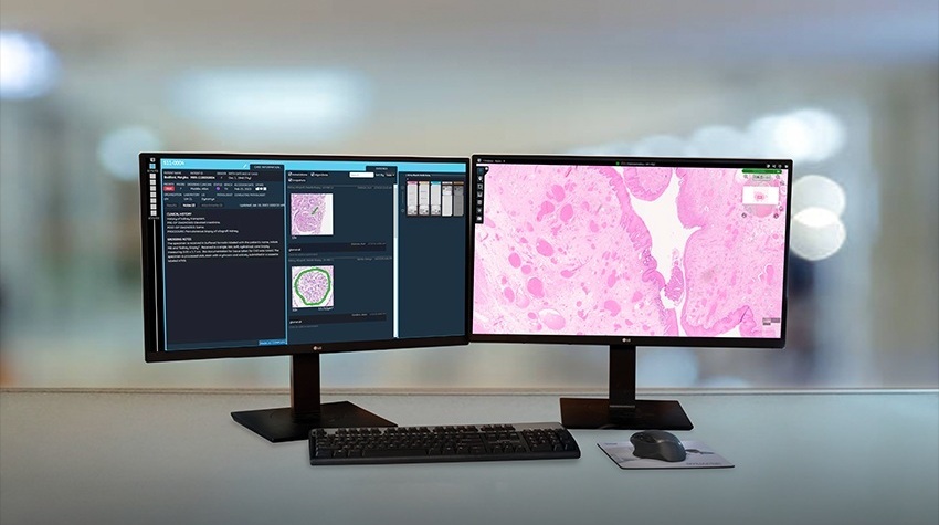Image: Fujifilm’s Synapse Pathology is a comprehensive pathology PACS that streamlines case management through proprietary advances in image digitization (photo courtesy of Fujifilm)
