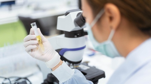 Image: The FDA The designation recognizes the test’s potential to aid Alzheimer’s diagnosis through a simple, non-invasive urine sample (Image credit: Shutterstock)