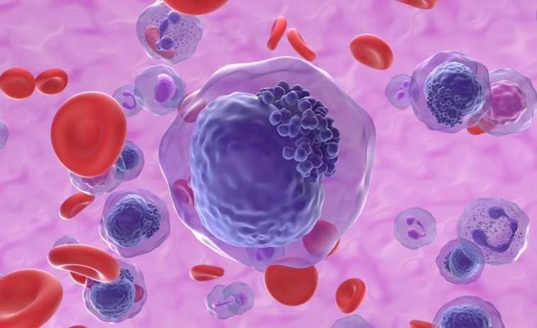 Image: Findings show that MRD‑guided intervention demonstrated the potential to delay or possibly prevent leukemic relapse (image credit: Shutterstock)