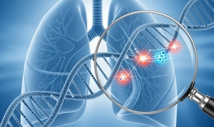 Image: Image: Findings showed that TP53 mutations correlate with lung cancer prognosis and may help guide therapy selection(image credit: Adobe Stock)