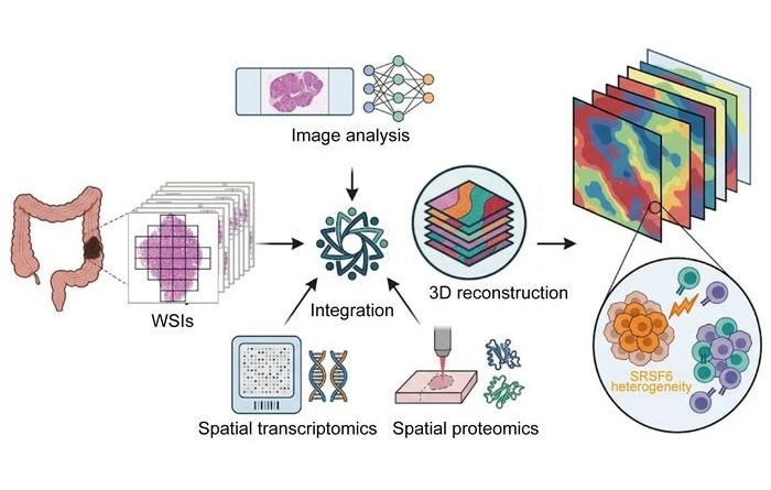 Image: The Deep Visual Spatial Transcriptomics and Proteomics (DVSTP) strategy integrates high-resolution pathology images with spatial transcriptomics and spatial proteomics to reveal the complex intra-tumor heterogeneity. DVSTP predicts molecular profiles from routine pathology slides, making spatial multi-omics more accessible. Whole–tumor 3D reconstruction reveals that SRSF6 drives immune exclusion and poor clinical outcomes (Photo courtesy of Science Bulletin)