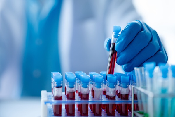 Image: A simple blood test could help identify which patients with head and neck cancer are most likely to benefit from immunotherapy (image credit: Adobe Stock)